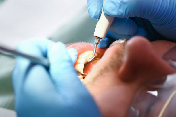 Best Cracked Tooth Emergency Dentist  in East Wenatchee, WA