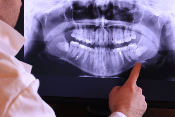 Best Chipped Tooth Repair Near Me  in East Wenatchee, WA