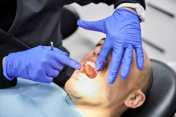 Emergency Dental Filling Replacement in WA