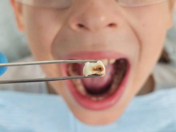 Best Tooth Infection Emergency Dentist  in East Wenatchee, WA